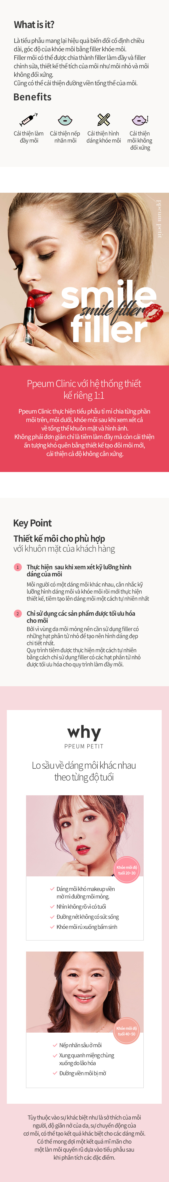 7. Kết quả tiêm môi khóe cười kéo dài bao lâu?